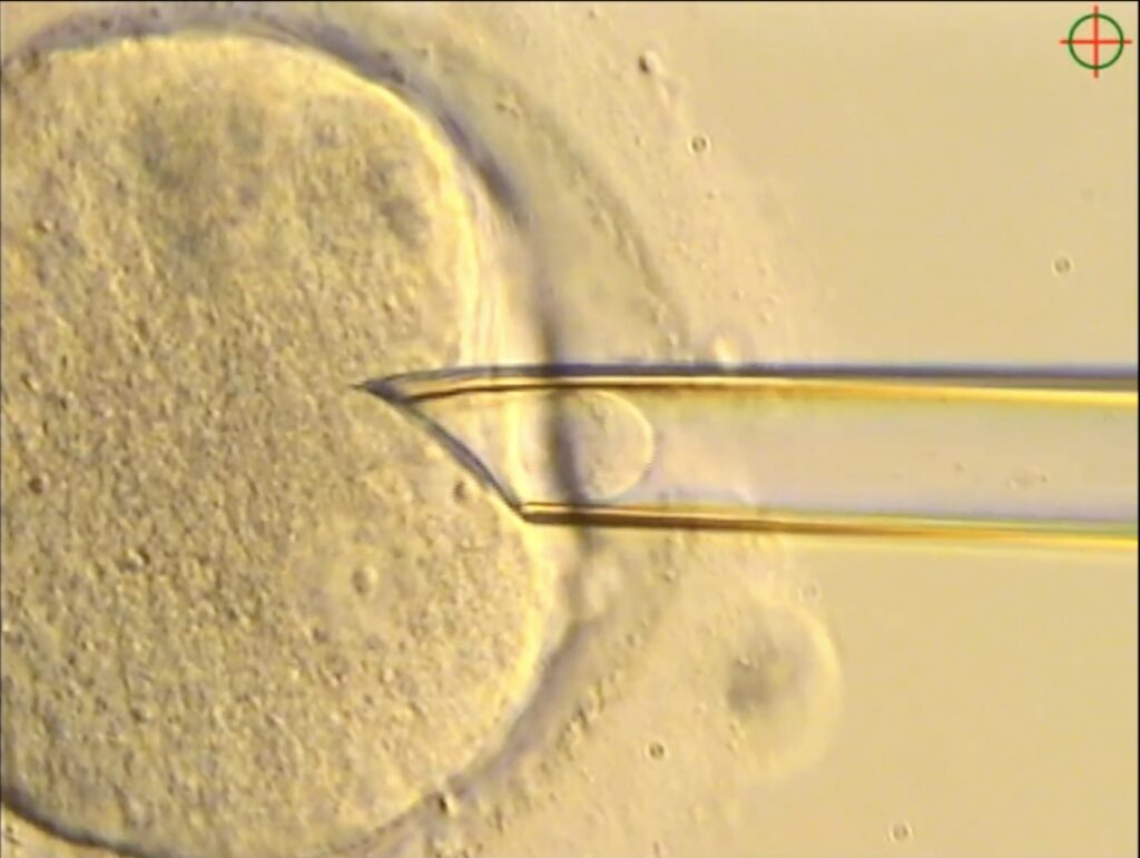 mitochondrial transfer